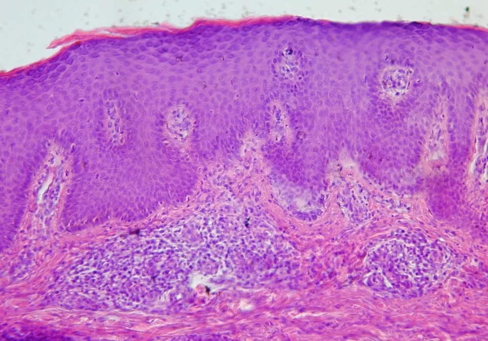 xx3.jpg,Mic.paeevleRV4.webp.pagespeed.ic.DeFGaIe2bR